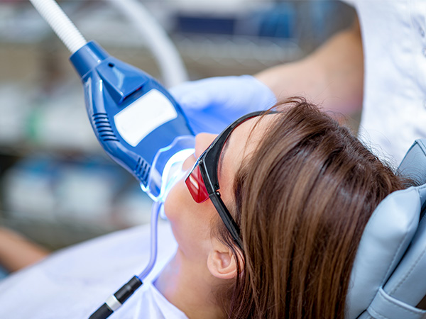 オフィスホワイトニング