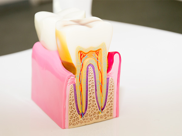 歯の神経イメージ画像